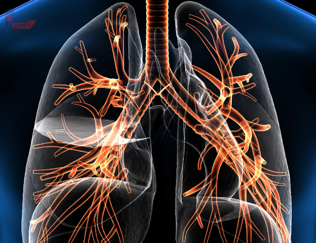 Respiratory conditions